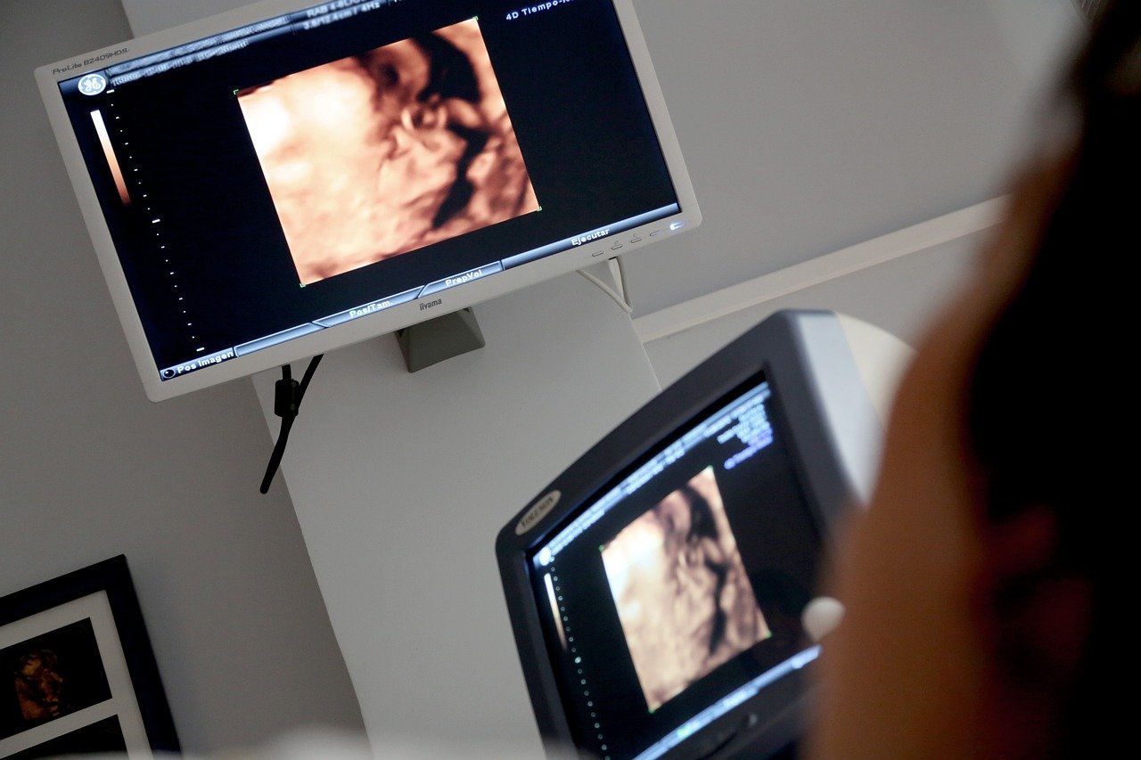 display, ultrasound, medical consultation, diagnosis, consultation, consulting room, ultrasound, ultrasound, ultrasound, ultrasound, ultrasound